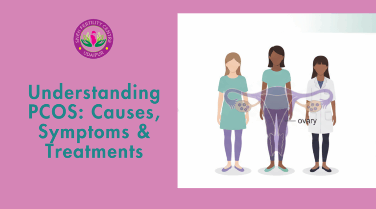 PCOS causes symptoms and treatments