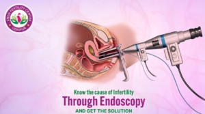 Know the Cause of Infertility Through Endoscopy and Get the Solution