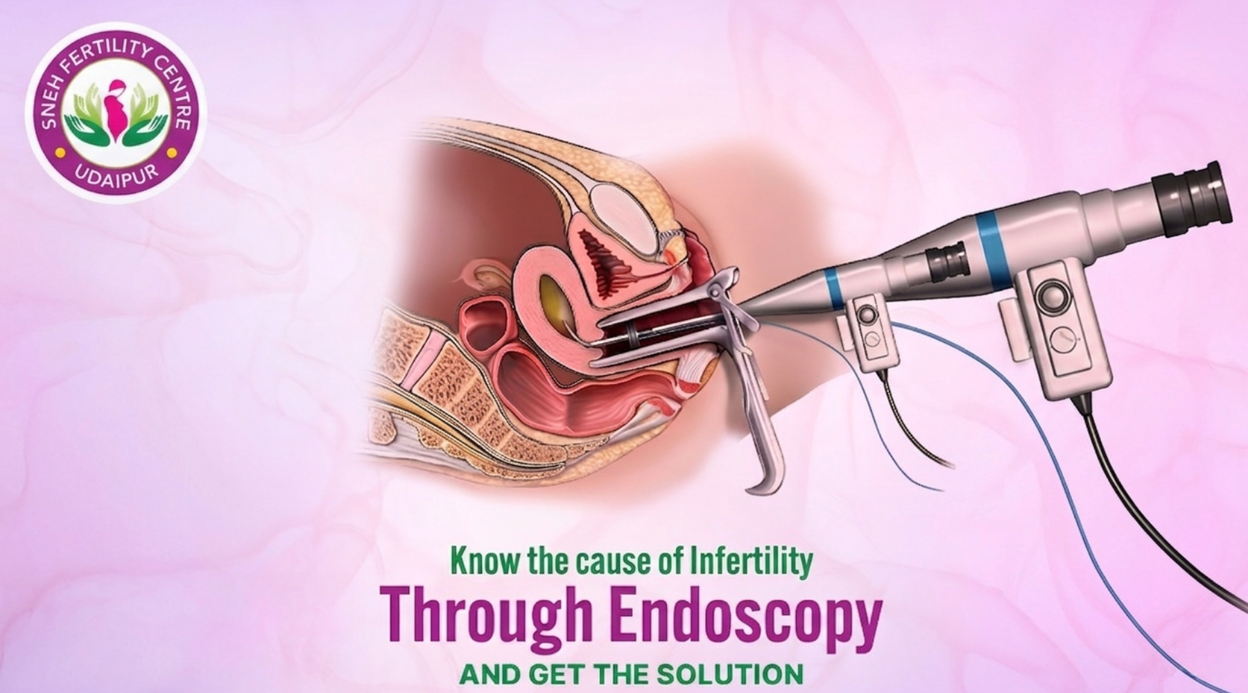 Know the Cause of Infertility Through Endoscopy and Get the Solution