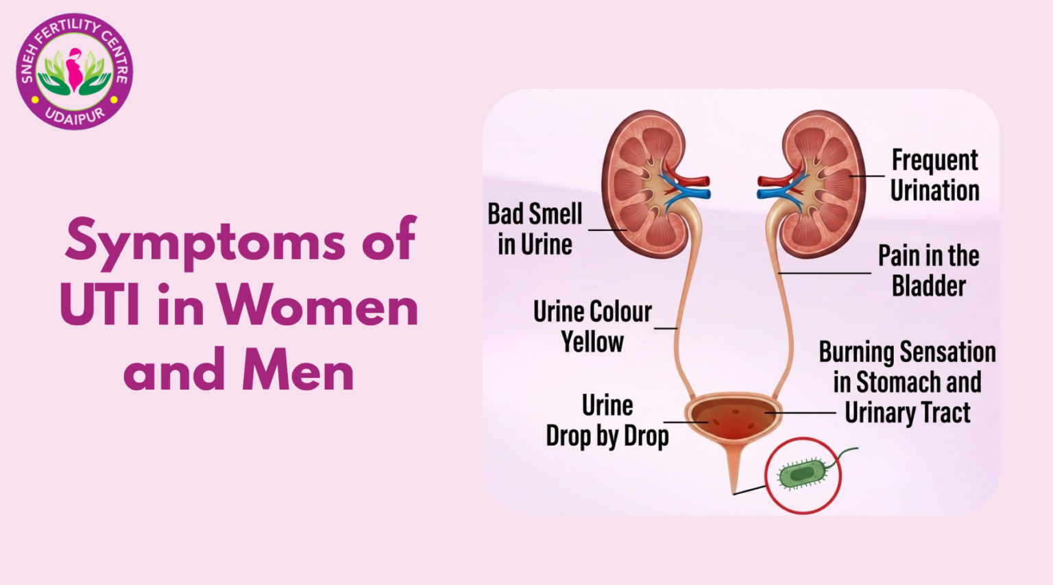 Common Uti UTI Symptoms in Women & Men | Urologist at Sneh Fertility & Urology Centre
