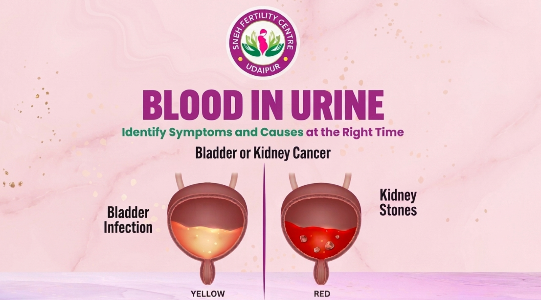 Blood in Urine: Identify Symptoms and Causes at the Right Time